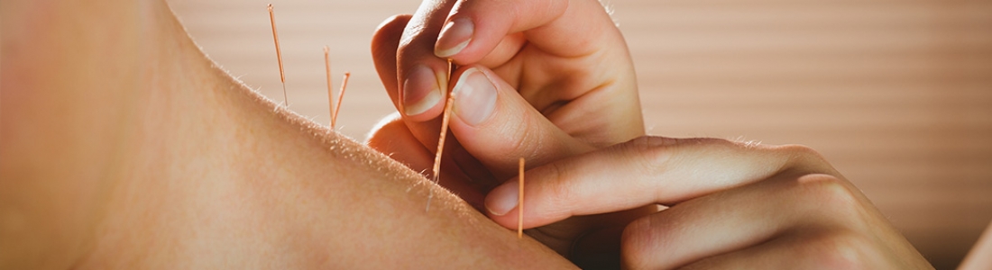 Acupuntura