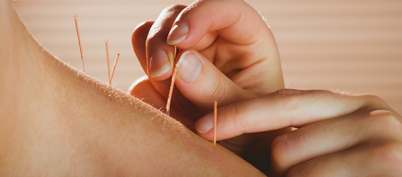 Acupuntura